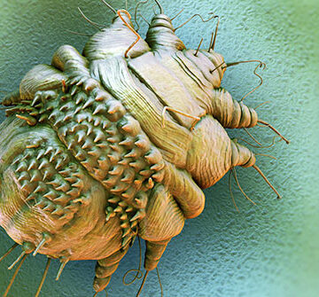 getty_rm_photo_of_sem_scabies_parasite Forget Mosquitoes,These parasites are Deadlier